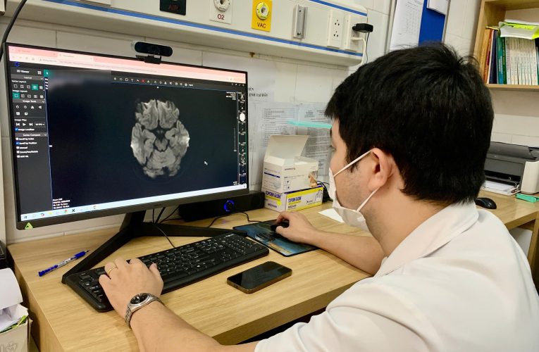 Nam sinh rối loạn tâm thần, tổn thương não vì thuốc lá điện tử