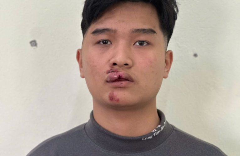 Công an xã Lương Bằng: Khởi tố vụ án, khởi tố bị can chống người thi hành công vụ